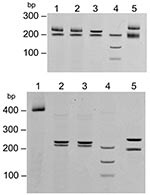 Thumbnail of Restriction fragment length polymorphism of the 17-kDa PCR product (434 bp) digested with AluI. Top: lane 1, 32-year-old woman; lane 2, 9-year-old girl; lane 3, Rickettsia akari–positive control; lane 4, R. rickettsii–positive control; lane 5, R. typhi–positive control. Bottom: lane 1, undigested 17-kDa gene PCR amplicon; lane 2, 9-year-old girl; lane 3, 32-year-old woman; lane 4, R. conorii–positive control; lane 5, R. honei–positive control.