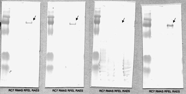 Western blot after cross-adsorption with (left to right) Rickettsia conorii, R. massiliae, R. felis, and R. aeschlimannii. When cross-adsorption is performed with R. felis, the specific antigen-corresponding line disappears, which indicates R. felis as the causative microorganism.