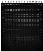 Thumbnail of Pulsed-field gel electrophoresis patterns of rmtC-positive Salmonella enterica serovar Virchow isolates. Lanes: B, S. Braenderup H9812 size standard; 1, H0 5164 0340; 2, H0 5366 0426; 3, H0 6018 0151; 4, H0 6136 0322; 5, H0 6398 0463; 6, H0 7078 0136; 7, H0 7310 0210; 8, H0 7468 0335; 9, H0 7474 0467; 10, H0 7496 0137; 11, H0 7512 0259; 12, H0 8354 0857; and 13, H0 8512 0713.