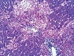 Thumbnail of Multifocal periportal and midzonal heptic necrosis in affected rabbit. Hematoxylin and eosin stain. Original magnification ×200.