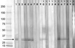 Thumbnail of Western blot analysis of serum reactivity to Enterocytozoon bieneusi proteins, Czech Republic. Serum selection: HIV-positive persons (indirect fluorescence antibody [IFA] assay titers &gt;400); blood donors, professionals with risk exposure (IFA titers &gt;200). Serum samples diluted 1:100. Molecular weight markers (Precision Plus Protein Standard, Bio-Rad Laboratories, Hercules, CA, USA): lane 1, positive control (HIV/AIDS patient with proved E. bieneusi infection); lane 2, negativ