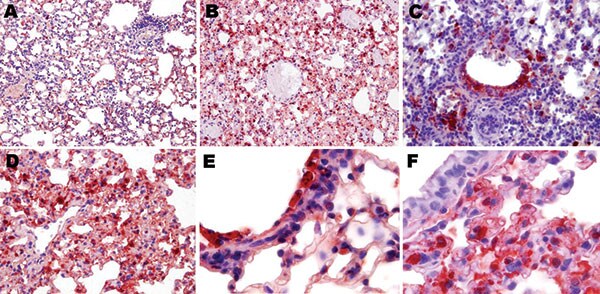 Topologic distribution of influenza antigens in the lungs of mice infected with influenza virus A subtype H1N1 and H5N1 strains at endpoint (antinucleoprotein immunohistochemical staining). A) Subtype H1N1 and B) subtype H5N1, both showing diffusely distributed positive staining of numerous pneumocytes and alveolar macrophages (original magnification ×100). C) Subtype H1N1, showing antigens massively present in the remaining non-desquamated airway epithelial cells (original magnification ×400);