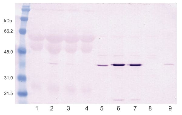 Western blot of infected duck embryonic fibroblasts (DEFs) showing avian bornavirus N-protein during culture. Lanes 1–4 are supernatant fluids. Lane I is from an African gray parrot (AG5). Lanes 2 and 3 are from a yellow-collared macaw (M24). Lane 4 is from uninfected DEFs. Lanes 5–8 are sonicated cell extracts. Lane 5 from AG5; 6 and 7 from M24; and Lane 8 from uninfected DEFs. Lane 9 is an infected brain control. The virus is strongly cell associated.