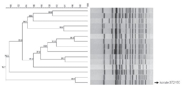 Dendrogram of pulsed-field gel electrophoresis patterns representative of the 15 largest clusters of Salmonella enterica serotype Typhi isolates identified in South Africa during 2005–2009. The pattern of isolate 372460 is indicated. Scale bar represents percentage similarity of pathogens.