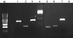 Thumbnail of Illustration of multispacer typing. Amplicons 1–4 result from PCRs on DNA obtained from 1 Rickettsia raoultii–infected Dermacentor reticulatus tick isolate; lanes 5–8 result from PCRs on 1 damaged isolate. PCRs amplifying dksA-xerC (lanes 1 and 5), mppA-purC (lanes 2 and 6), and rpmE-tRNA (lanes 3 and 7) intergenic spacers were performed as described (5). PCR amplifying the entire internal transcribed factor 2 (ITS2) locus of D. reticulatus tick (lanes 4 and 8) was involved in each