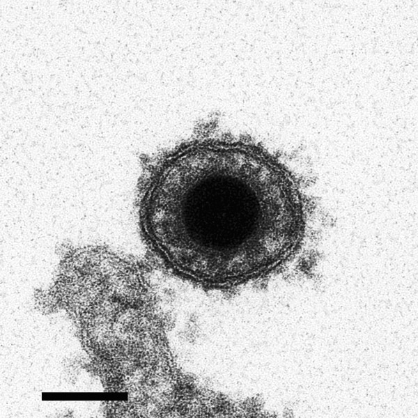 Electron micrograph image of cyprinid herpesvirus 3 virion. Scale bar = 100 nm. Adapted with permission from Mettenleiter et al. (7).