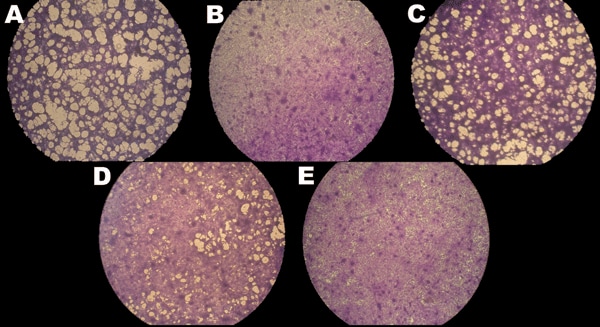 Effects of temperature on cyprinid herpesvirus 3 replication in Cyprinus carpio carp brain cells. After infection, cells were kept at 22°C (A) or shifted to 30°C (B–D); some cells were returned to 22°C at 24 hours (C) or 48 hours (D) postinfection. Uninfected control cells (E) and infected cells at 9 days postinfection were fixed, stained, and photographed. Viral replication was highest in cells maintained at 22°C and lowest in those maintained at 30°C. Original magnification ×20. Adapted with p