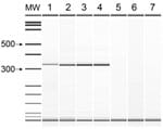 Thumbnail of PCR amplification with primers TFR3 and TFR4. Lane 1, Tritrichomonas foetus ATCC 30231; lane 2, peritoneal fluid specimen; lane 3, culture of peritoneal fluid; lane 4, T. suis ATCC 30167; lane 5, Pentatrichomonas hominis; lane 6, Trichomonas tenax; lane 7, no template control. MW, molecular size standard. Values at left are bp.