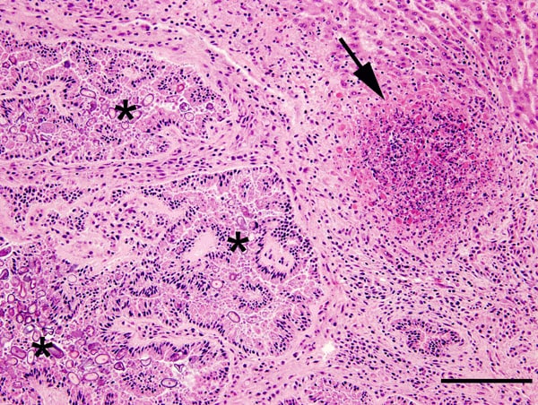 Liver from a juvenile wild rabbit with numerous oval Eimeria stiedae oocysts in the convoluted hyperplastic bile ducts (asterisks) and necrotizing hepatitis (arrow) by Francisella tularensis. Hematoxylin and eosin stain; scale bar = 200 µm.