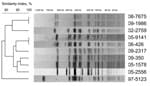 Thumbnail of XbaI pulsed-field gel electrophoresis (PFGE) profiles obtained from 10 Salmonella enterica serotype Typhi isolates belonging to subpopulation B. The dendrograms generated by BioNumerics version 3.5 software (Applied Maths, Sint-Martens-Latem, Belgium) show the results of cluster analysis on the basis of PFGE fingerprinting. Similarity analysis was performed by using the Dice coefficient, and clustering was done by using the unweighted pair-group method with arithmetic averages.