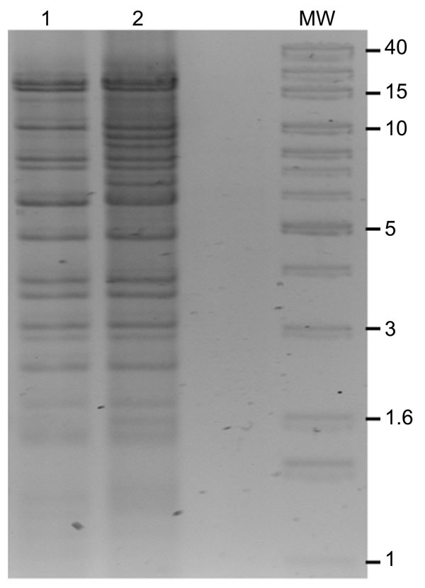 BglII restriction digests of New Delhi metallo-β-lactamase (pNDM)–Kp10469 (lane 1) and pNDM-Ec10505 (lane 2). MW, 1-kb extension ladder molecular mass marker (Invitrogen, Carlsbad, CA, USA). Sizes (kb) are indicated for some bands.