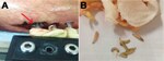 Thumbnail of Pin-site myiasis in a 26-year-old male soldier, Colombia. A) Larvae of Cochliomyia hominivorax screwworm fly around an external metallic fixator (arrow). B) Larvae isolated from the insertion wound of the external metallic fixator