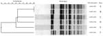 Thumbnail of Dendrogram and selected pulsed-field gel electrophoresis (PFGE) patterns of XbaI-digested Shiga toxin 1–producing Shigella sonnei isolates from California. Predominant XbaI patterns identified in cluster 1 are shown in rows A and B and outlier on row F. Predominant patterns identified in cluster 2 are shown in rows C and E and outlier on row D. ID no., identification number.