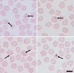 Thumbnail of Representative images of small intracellular Babesia (arrows) identified in sheep erythrocytes from several sites in northeastern Scotland, UK. Both paired piroforms and ring forms are visible. Images were taken at ×1,000 magnification with oil immersion. Scale bar indicates 5 μm.