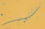 Microscopic image of Dirofilaria repens microfilaria in case study of microfilaremic D. repens infection in patient from Serbia. A blood sample from the patient was processed and stained with methylene blue. Scale bar indicates 200 μm.