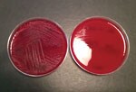 Thumbnail of Blood agar plates with (left) and without (right) pyridoxal supplement from a study of neonatal Granulicatella elegans bacteremia, London, UK. Image from Neonatal Granulicatella elegans Bacteremia, London, UK; Emerging Infectious Diseases Vol. 19, no. 7, July 2013.