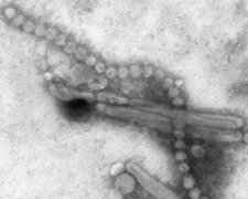 An influenza A H7N9 virus as viewed through an electron microscope. Both filaments and spheres are observed in these photos.