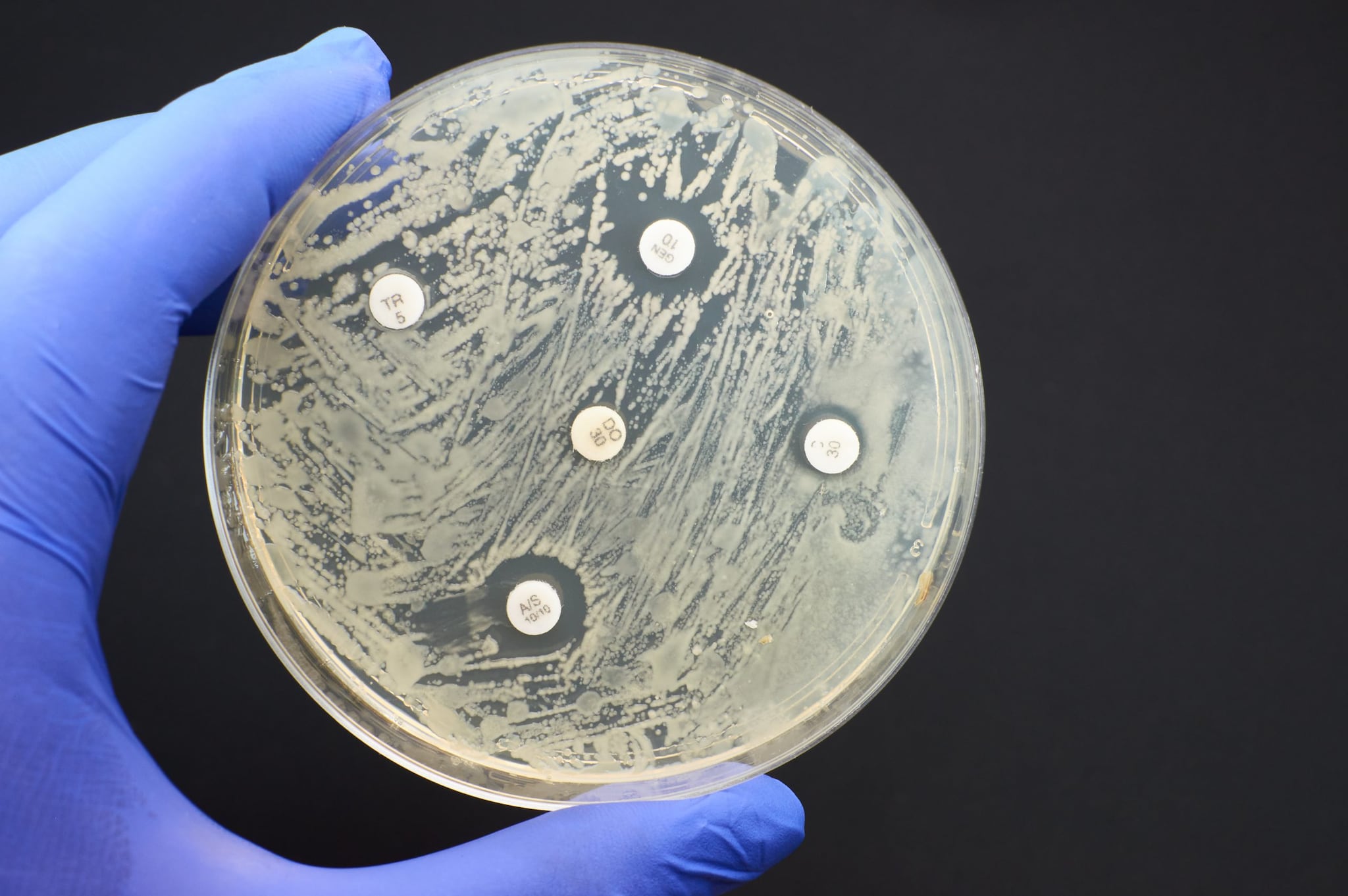 This image shows germs being grown on an agar plate in a lab.