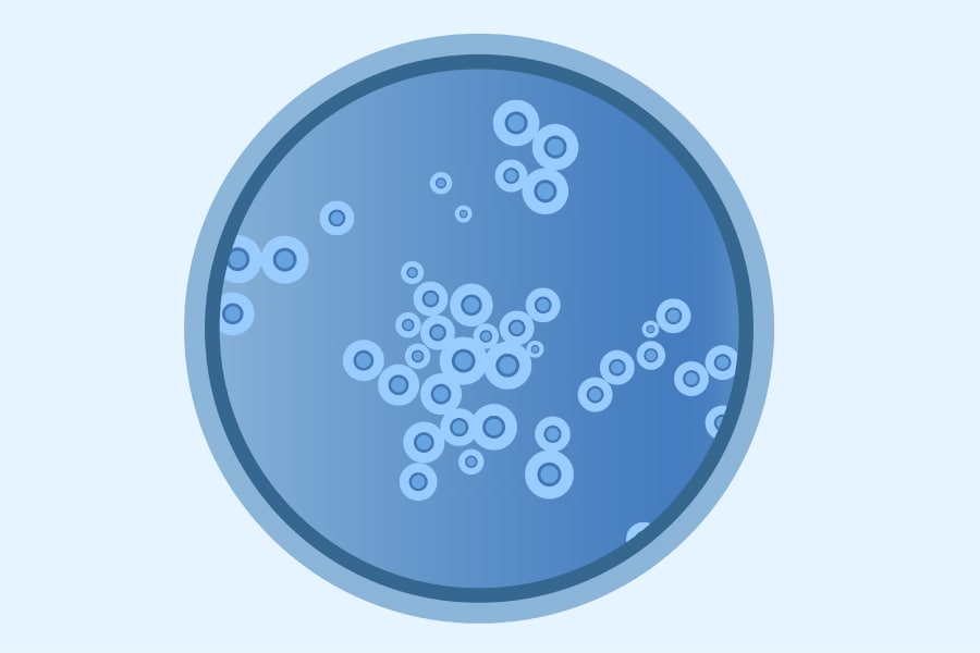 Image of a CGatti disease cell