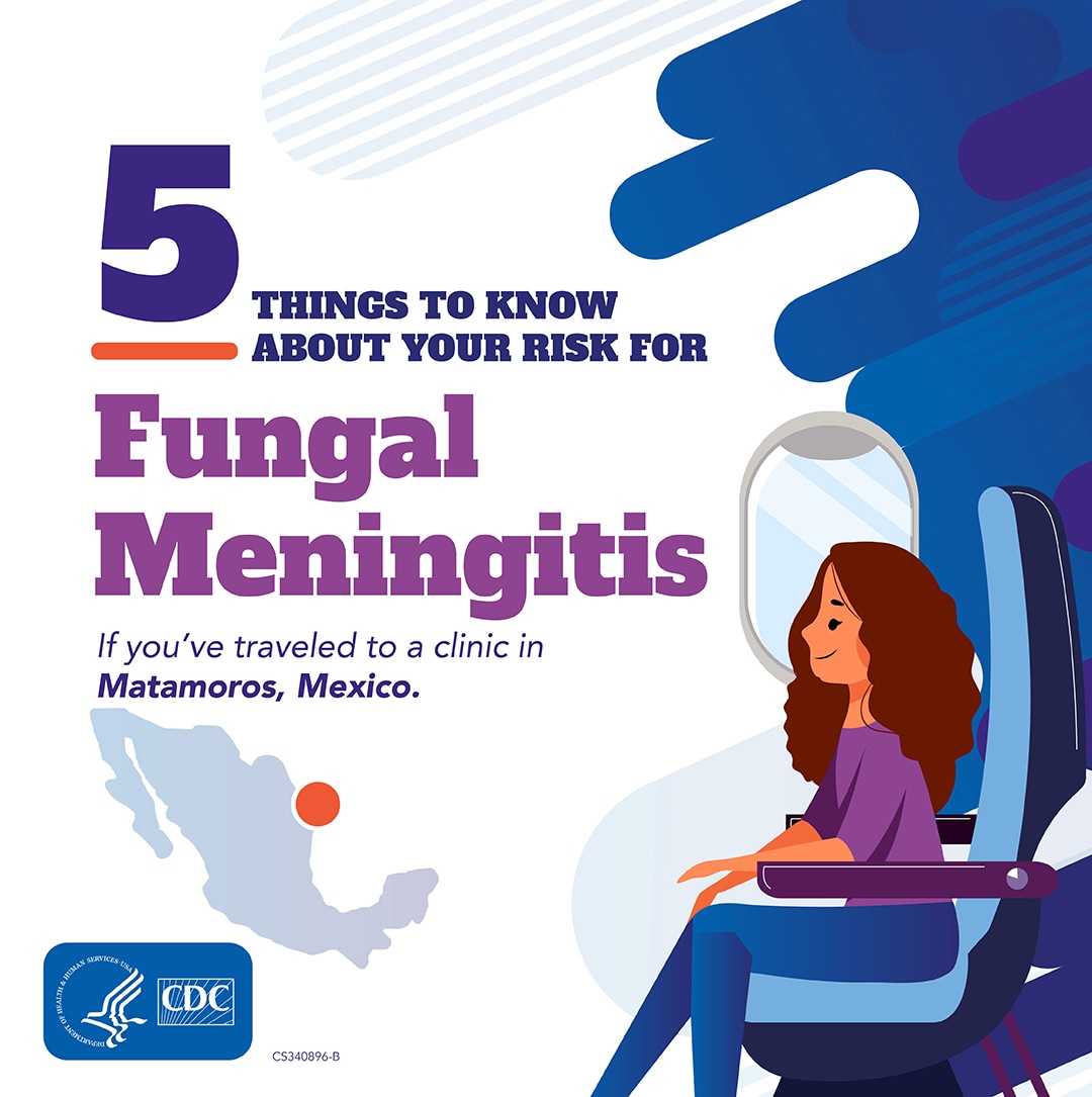 5 things to know about the fungal meningitis outbreak: This affects people, including U.S. residents, who had epidural anesthesia in Matamoros, Mexico.