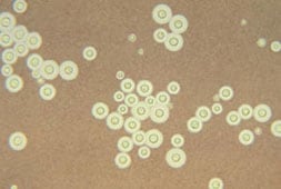 Photomicrograph of Cryptococcus