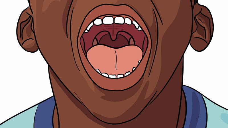 primer plano del interior de la boca de una persona con una garganta sana