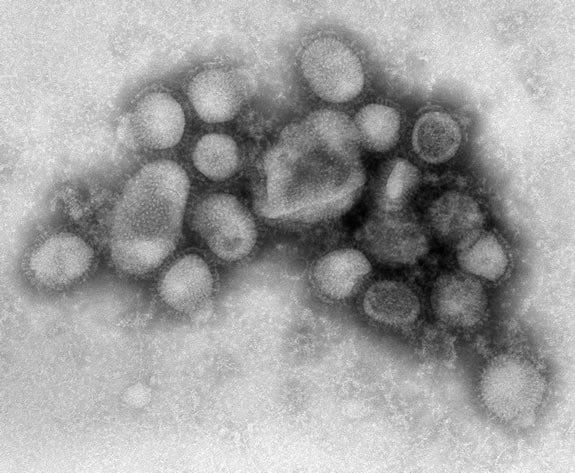 Imagem do vírus influenza A (H1N1) produzida nos laboratórios do CDC, em Atlanta (EUA)