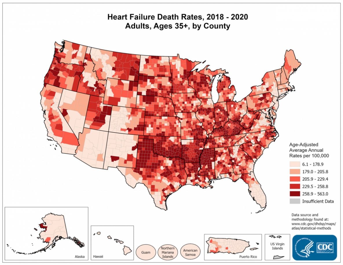 Heart Failure Death Rates for 2018 through 2020 for Adults Aged 35 Years and Older by County. The map shows that concentrations of counties with the highest heart disease death rates - meaning the top quintile - are located primarily in Mississippi, Louisiana, Arkansas, Oklahoma, Texas, Kentucky, Tennessee, Indiana, Illinois, and Wisconsin. Pockets of high-rate counties also were found in Oregon, Utah, Montana, South Dakota, and Nebraska.