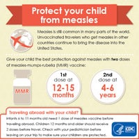 Infographic: Protect your child from measles. Measles is still common in many parts of the world. Unvaccinated travelers who get measles in other countries continue to bring the disease into the United States. Give your child the best protection against measles with two doses of measles-mumps-rubella (MMR) vaccine.