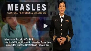 Video: Measles Clinical Features & Diagnosis