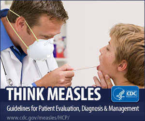 Think Measles. Guidelines for Patient evaluation, Diagnosis and Management. Www.cdc.gov/measles/hcp/
