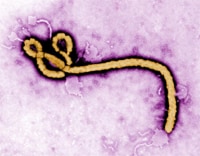 Colorized transmission electron micrograph (TEM) revealing some of the ultrastructural morphology displayed by an Ebola virus virion. 