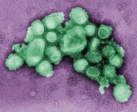 Source: CDC Library;Swine Influenza (Flu)
