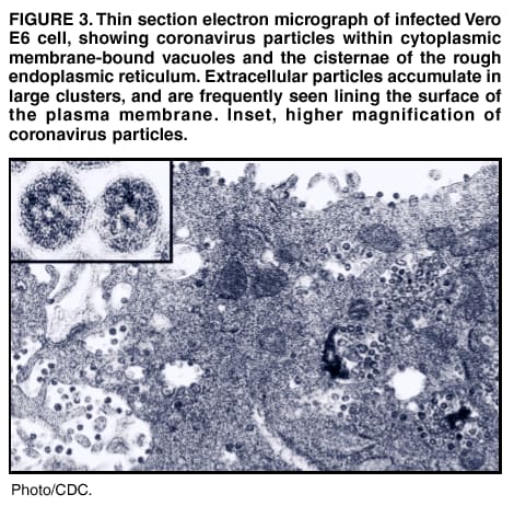 Source CDC.Coronavirus particles.
