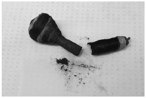 The figure shows the Nigerian tiro container and the powder that was applied to the lead-poisoned child's eyelids in Boston, Massachusetts, in 2011.