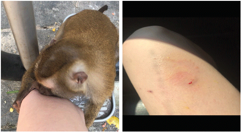 The figure consists of two photos; one shows a macaque biting an Oregon teen on the leg, and the second shows the resultant wound.