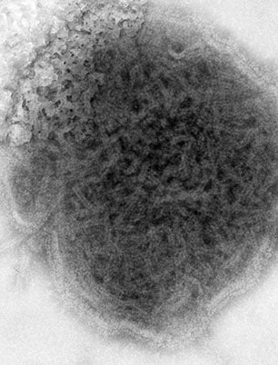 Microfotografía electrónica de transmisión (TEM) con tinción negativa, tomada en 1973, mostrando las características ultraestructurales del virus de las paperas.