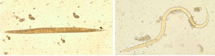 Two images of parasites. On the left is an adult free-living female S. stercoralis. Two rows of eggs are visisble within the female’s body. On the right is a Filariform (L3) larva of S. stercoralis in an unstained wet mount.