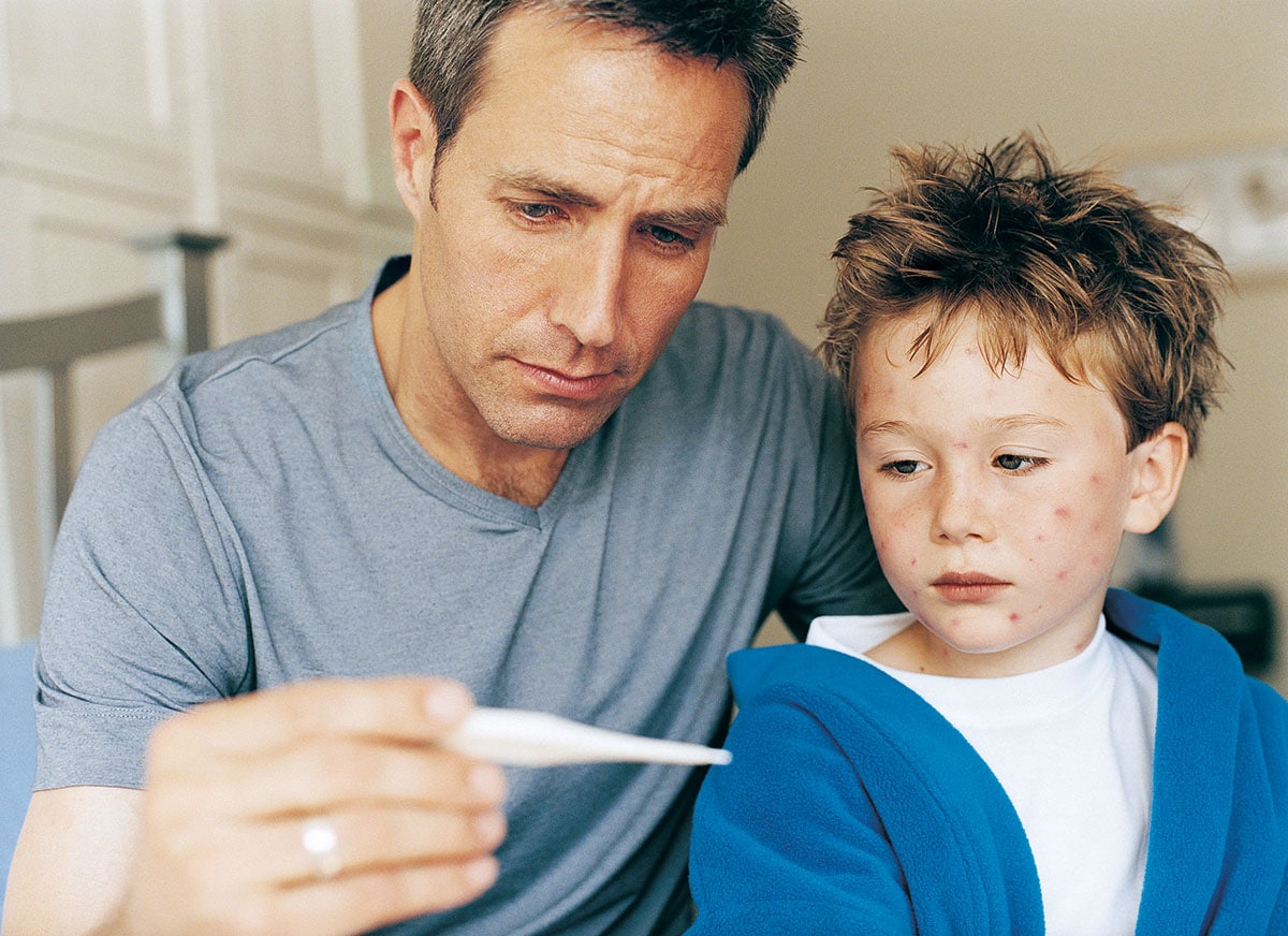 A young boy with a chickenpox rash looking at a thermometer with an adult