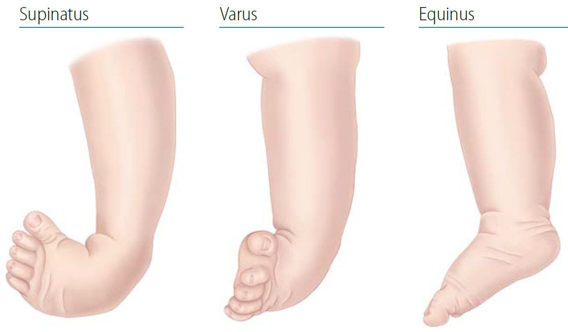 foot positions