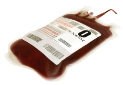 Blood Transfusion  on Cdc   Tratamientos Para La Adb  Transfusi  N   Ncbddd