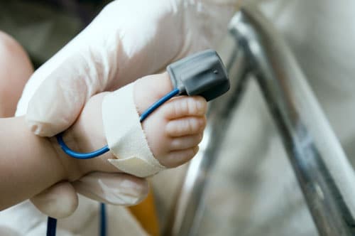 Doctor performing pulse oximetry test