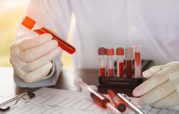 Lab worker handling blood samples
