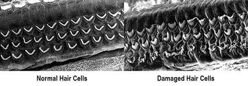 combined normal damaged hair cells labeled