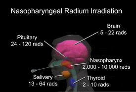 A description of radiation exposure to nearby organs as a result of Nasopharyngeal Radium Irradiation (NRI)