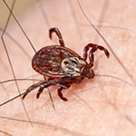 Female blood-sucking mite crawling on a hairy human skin macro