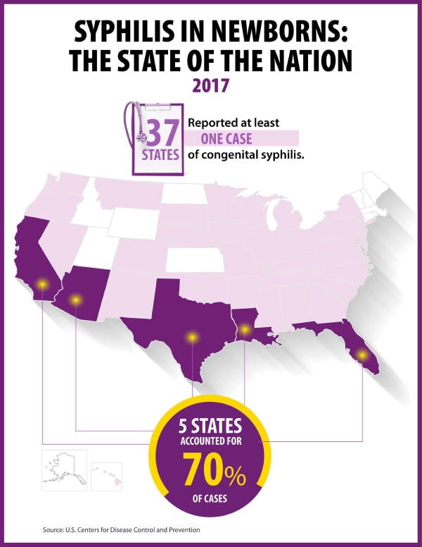 This map highlights the five states that accounted for 70% of the congenital syphilis cases: Arizona, California, Florida, Louisiana, and Texas.