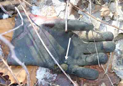 arrow pointing to burn mark on decendent's glove