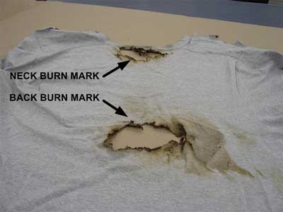 neck and back burn marks on T-shirt
