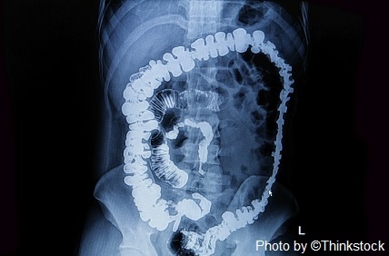 x-ray of small and large intestines